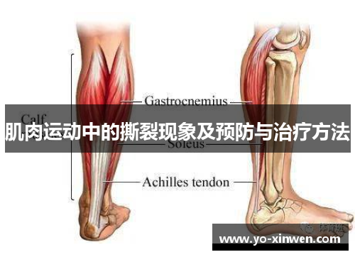 肌肉运动中的撕裂现象及预防与治疗方法